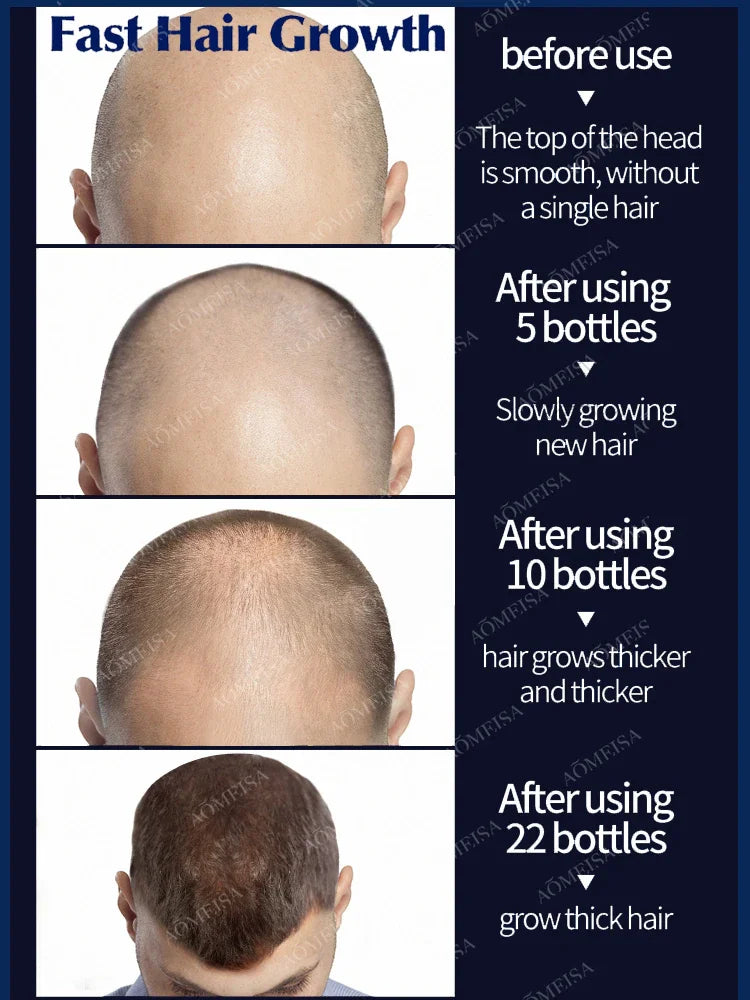 The gentle formula is suitable for sensitive scalps, deeply nourishing without irritation, leaving hair with natural vitality.