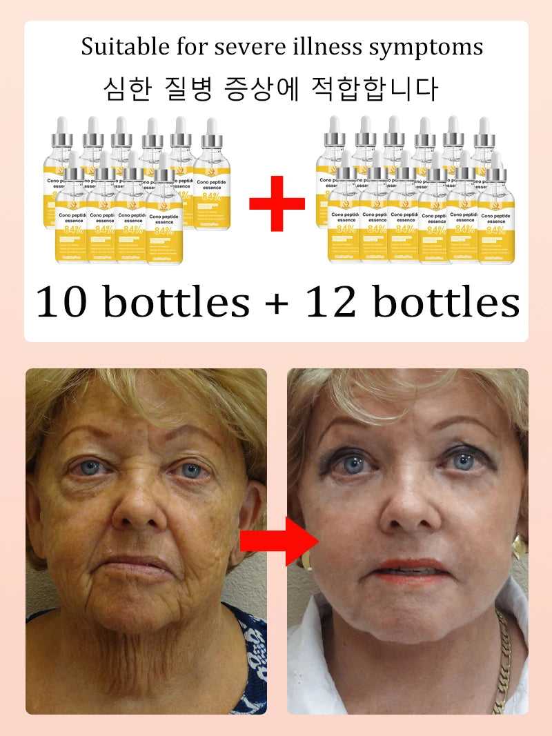 2026 new age-preventive，20 years younger