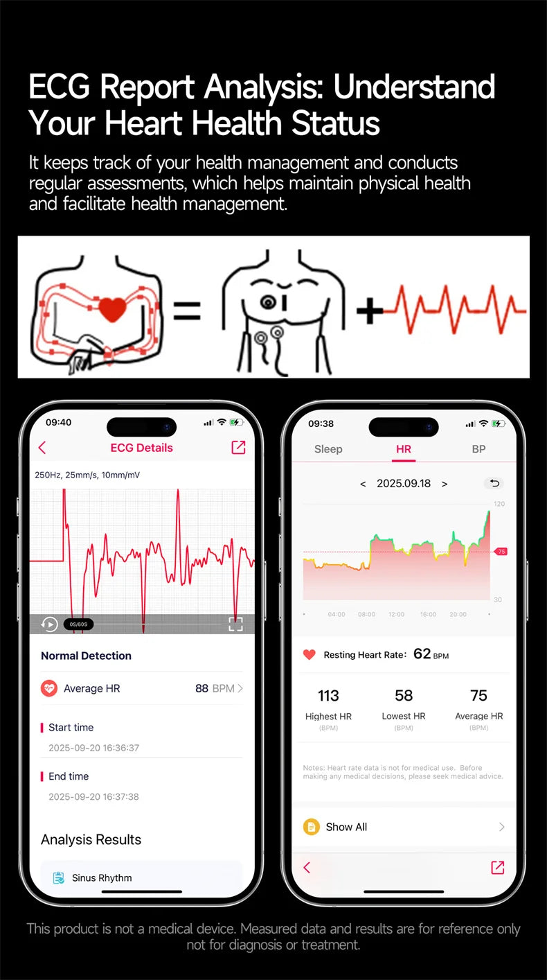 2026New Health Diagnosis Smart Watches Men Sport ECG Heart Rate Blood Pressure Uric acid Waterproof Smartwatches For Men women