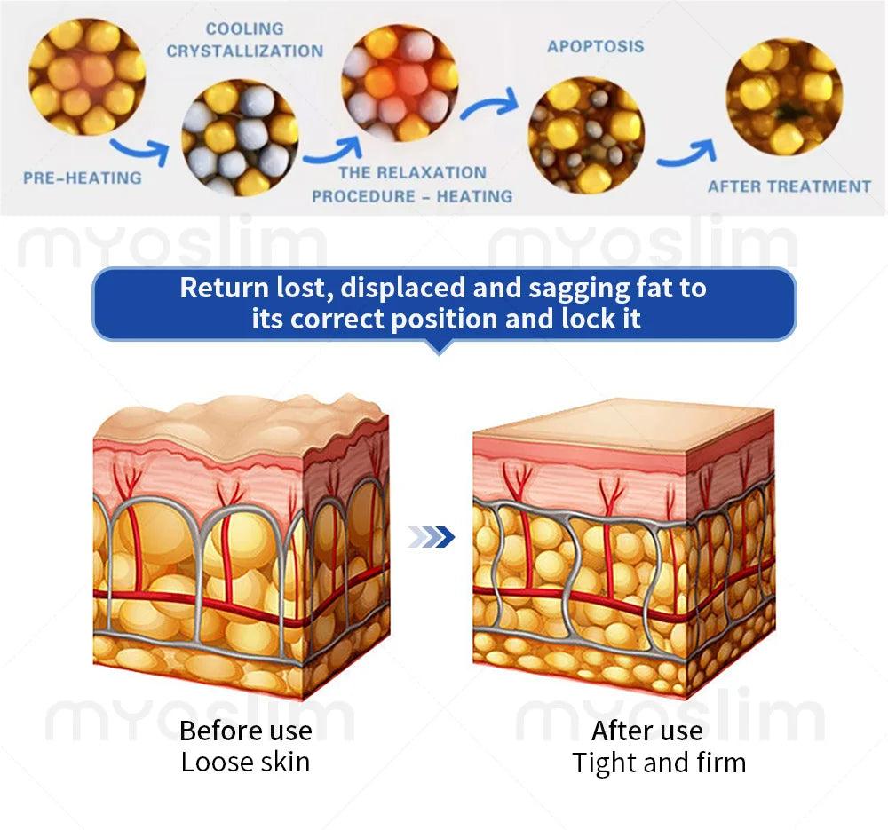 NEW Cool T Shock Cryoskin 4.0 Machine Portable Equipment Hot and Cold Skin Tightening Loss Weight Body Slimming Machine