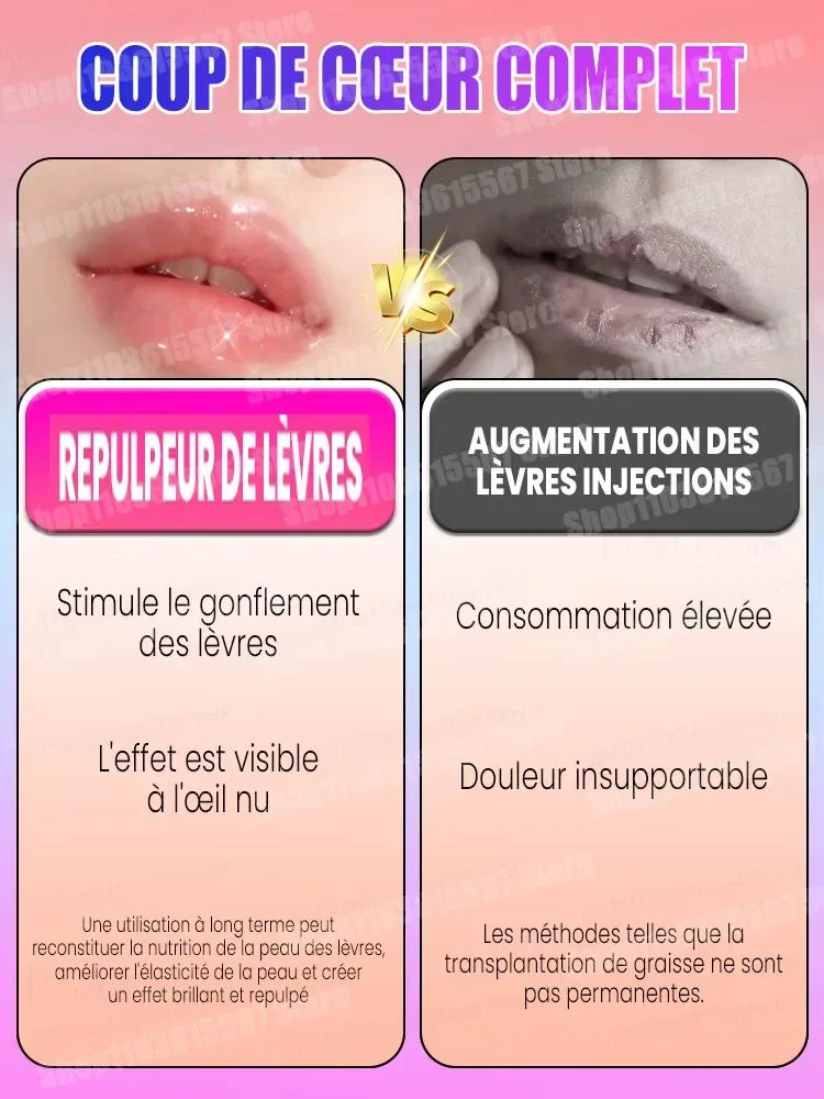 Perfect lip augmentation-Sexy and plump lip shape