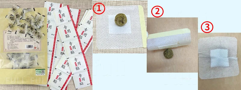 Herb Ball Fat Burning Slimming Patches Anti Cellulite Belly Detox Navel Sticker Weight Losing Fast Slim Plaster Slimming Product