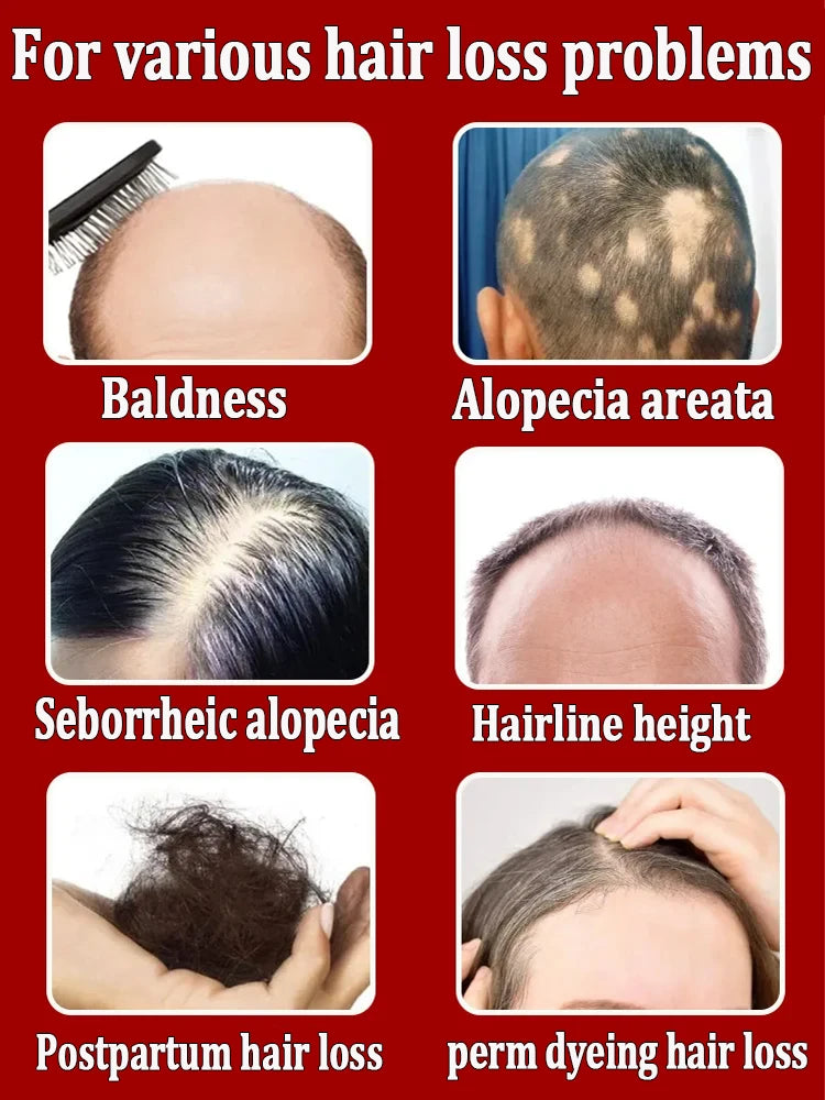 The gentle formula is suitable for sensitive scalps, deeply nourishing without irritation, leaving hair with natural vitality.