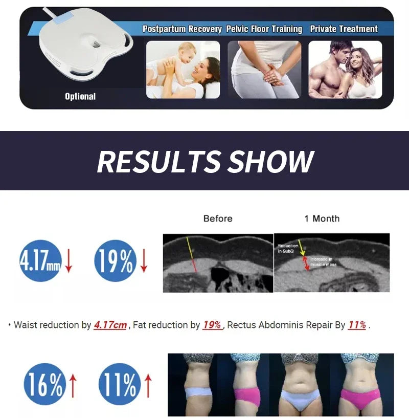 HIEMT EMSZERO RF High Intensity EVibration Pulse Electromagnetic Body Shaping Professional Muscle Growth And Fat Burning  Machin