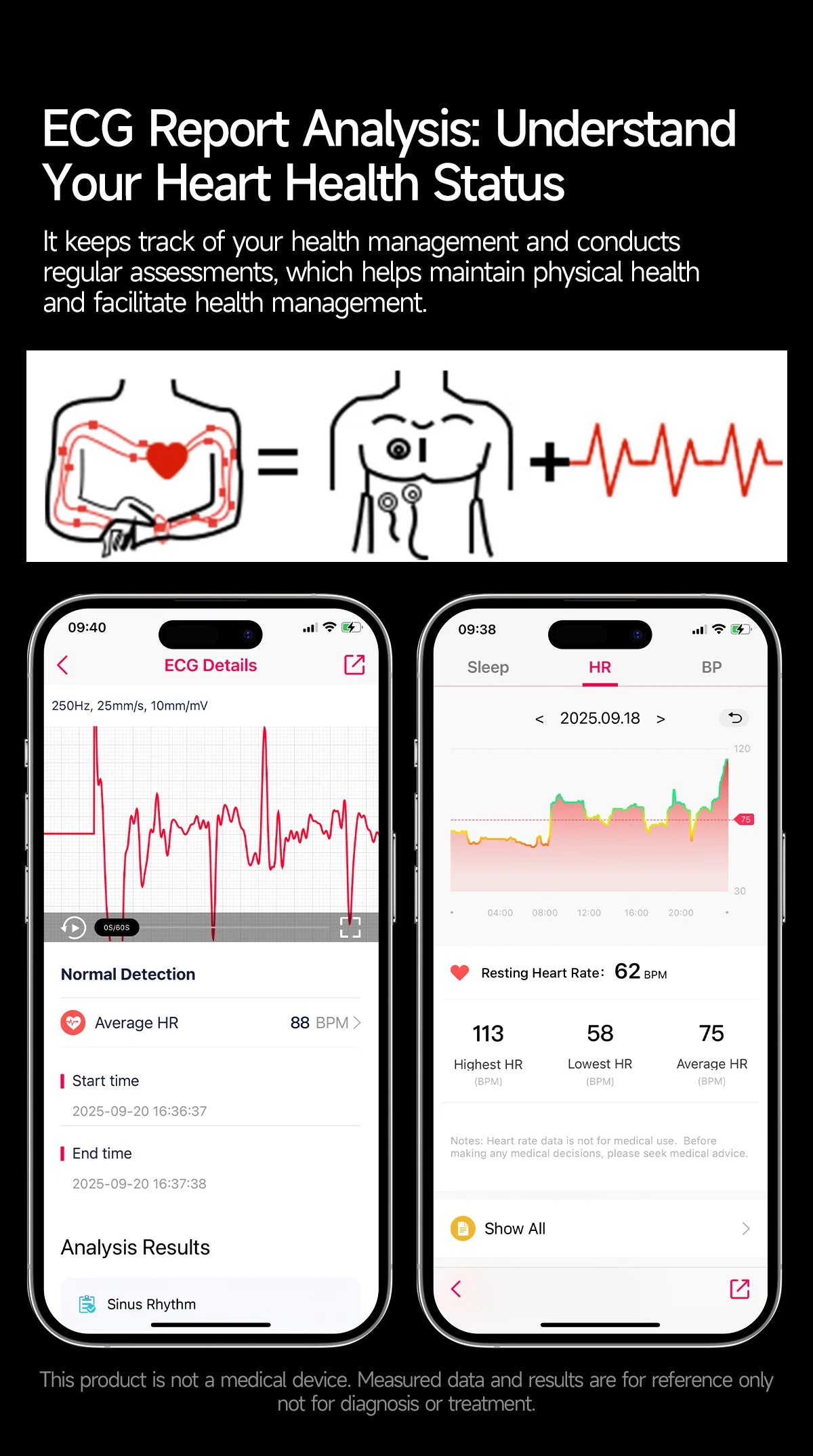 Nursing Grade Health Smartwatches For Men Women Precision Detection Heart Rate Blood Fats Uric Acid Blood Pressure ECG Smart Wat