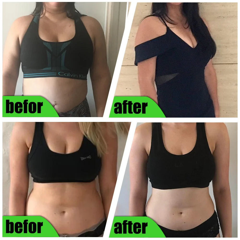 30/60/90Pcs Herbal Belly Slim Patch To Lose Weight Fast Slimming Pill Body Shaper Tummy Navel Plaster Burns Abdominal Fat Burner