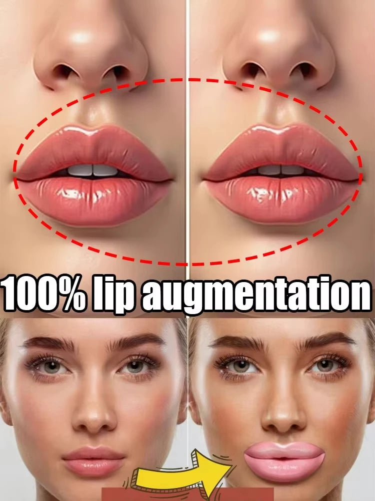 Perfect lip augmentation-Sexy and plump lip shape