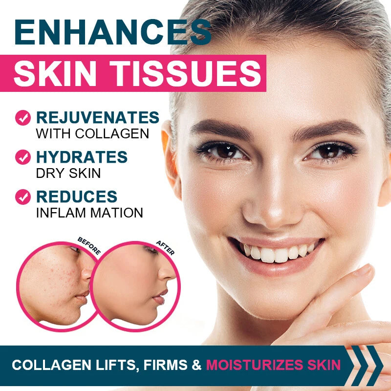 Collagen Biotin Capsules for Extra Strength Boost Hair, Skin and Nails Improve Skin Texture Hair Growth Follicle Repair