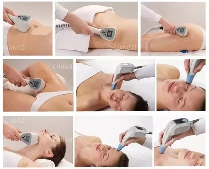 Portable NEO Device Slimming Machine Ultrasonic Fat Removal Wrinkle Removal Face Slimming Double Handle Super Strong 360 Degree