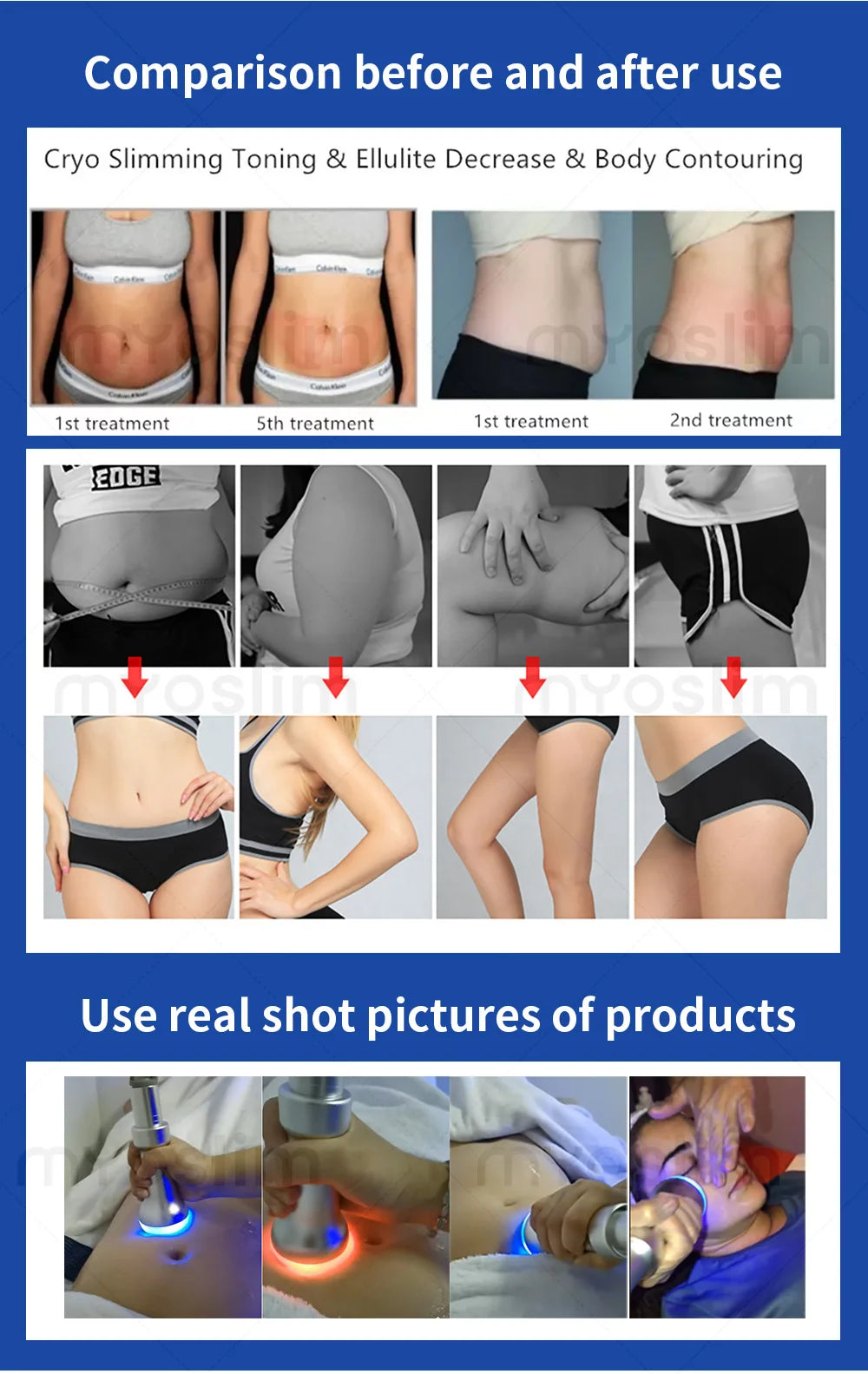 NEW Cool T Shock Cryoskin 4.0 Machine Portable Equipment Hot and Cold Skin Tightening Loss Weight Body Slimming Machine